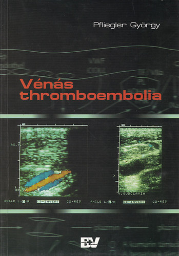 Könyv: Vénás thromboembolia (Pflieger György)