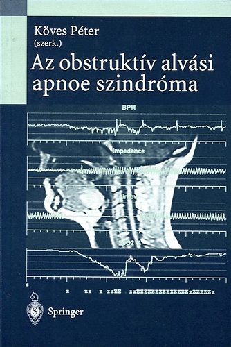 Köves Péter (szerk.): Az obstruktív alvási apnoe szindróma