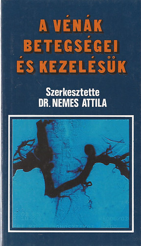 Dr.Nemes Attila: A vénák betegségei és kezelésük