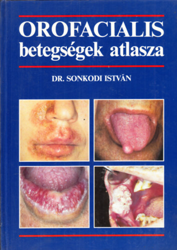 Dr. Sonkodi István: Orofacialis betegségek atlasza