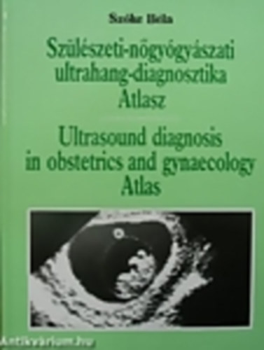 Szőke Béla: Szülészeti-nőgyógyászati ultrahang-diagnosztika Atlasz