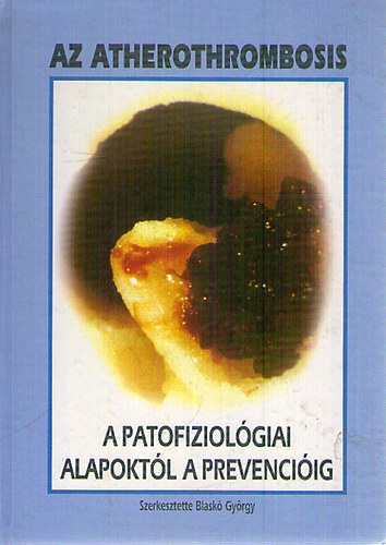 Dr. Blaskó György: Az atherothrombosis a patofiziológiai alapoktól a prevencióig