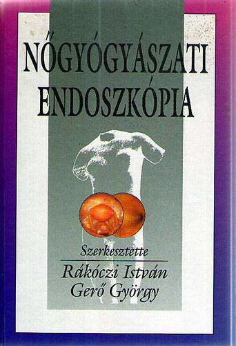 Rákóczi István - Gerő györgy: Nőgyógyászati endoszkópia