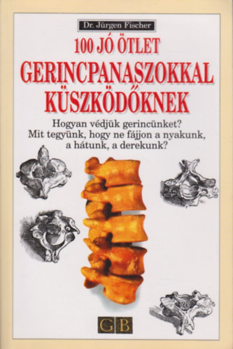 Dr. Jürgen Fischer: 100 jó ötlet gerincpanaszokkal küszködőknek