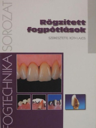 Róth Lajos (szerk.): Rögzített fogpótlások