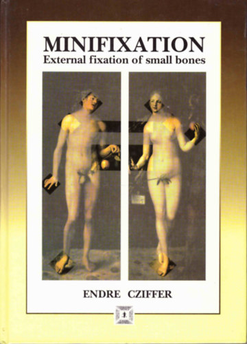 Cziffer Endre: Minifixation: External Fixation of Small Bones