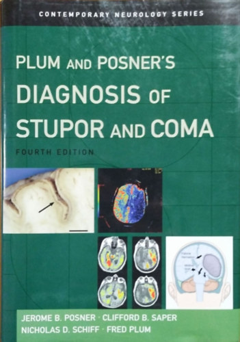 Jerome B. Posner - Clifford B. Saper - Nicholas D. Schiff - Fred Plum: Plum and Posner's Diagnosis of Stupor and Coma (4th edition)